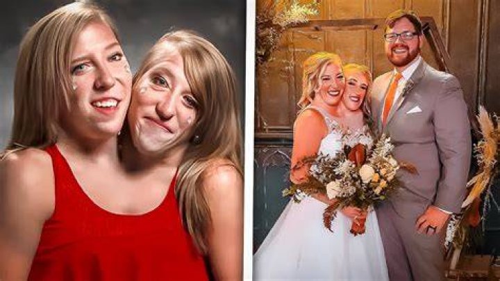 Discoveries In "2 Headed Twins Married"